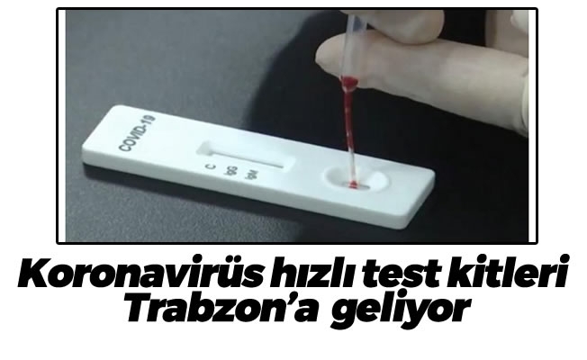 Koronavirüs hızlı test kitleri Trabzon’a  geliyor