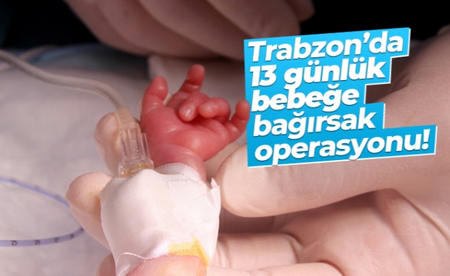 Trabzon'da 13 günlük bebeğe bağırsak operasyonu!